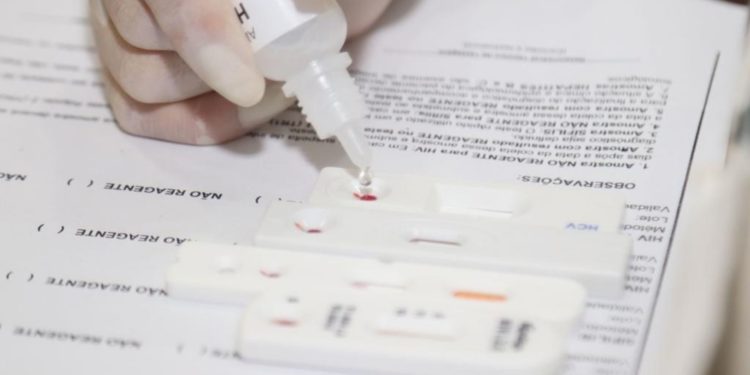 Pela segunda vez do mês de outubro, Amazonas não registra óbitos por Covid-19