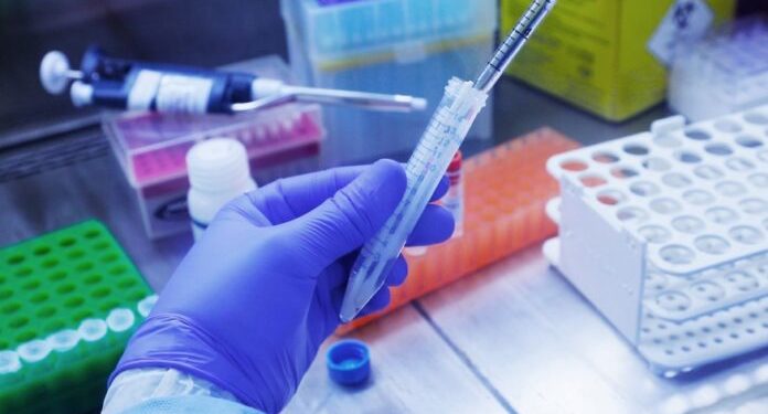 Covid-19: Fiocruz negocia entrega de 180 milhões de doses de vacina para 2022