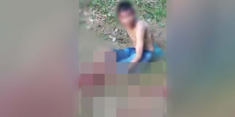 Adolescente tem pé decepado por moradores após assalto em Manacapuru
