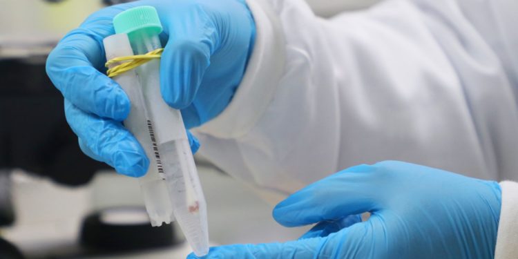 Amazonas informa boletins da Covid-19, Mpox e vacinação nesta sexta-feira (16/12)