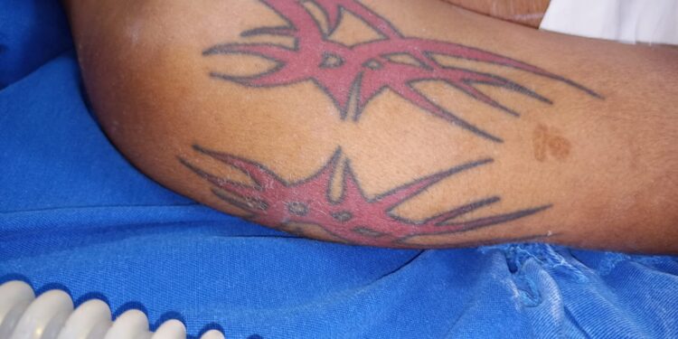 HPS João Lúcio procura familiares de paciente sem identificação internado na unidade