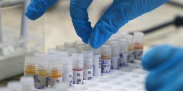 Amazonas atualiza boletins da Covid-19, Mpox e vacinação nesta segunda-feira