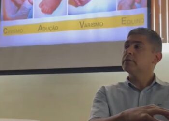 Maternidade Moura Tapajóz promove capacitação sobre problemas ortopédicos em recém-nascidos
